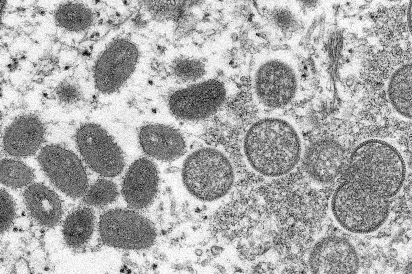 Reife, ovale Affenpockenviren (l) und kugelförmige unreife Virionen (r) aus einer menschlichen Hautprobe: Fälle der eigentlich seltenen Affenpocken werden mittlerweile in immer mehr Lände...